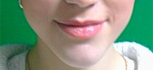 Before lip shape correction